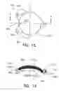 Fig. 09 - Refractive intraocular implant lens and method