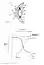 Fig. 02 - Accommodating intraocular lens