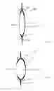 Fig. 04 - Accommodating intraocular lens
