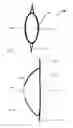 Fig. 05 - Accommodating intraocular lens