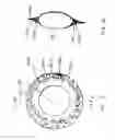 Fig. 06 - Accommodating intraocular lens