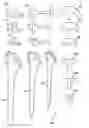 Fig. 01 - Shoulder implant assembly