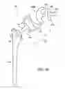 Fig. 05 - Shoulder implant assembly