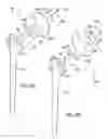 Fig. 06 - Shoulder implant assembly