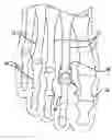 Fig. 01 - Metatarsal implant