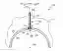 Fig. 01 - Modular hip cup assembly, fastener assembly & fastener