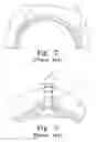 Fig. 04 - Modular hip cup assembly, fastener assembly & fastener