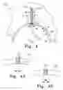 Fig. 05 - Modular hip cup assembly, fastener assembly & fastener