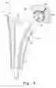 Fig. 06 - Modular hip cup assembly, fastener assembly & fastener