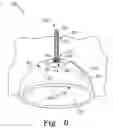 Fig. 10 - Modular hip cup assembly, fastener assembly & fastener