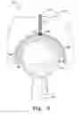 Fig. 11 - Modular hip cup assembly, fastener assembly & fastener