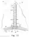 Fig. 13 - Modular hip cup assembly, fastener assembly & fastener