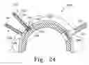 Fig. 23 - Modular hip cup assembly, fastener assembly & fastener