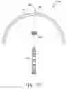 Fig. 26 - Modular hip cup assembly, fastener assembly & fastener