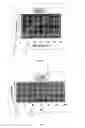 Fig. 03 - Control systems for rotary blood pumps