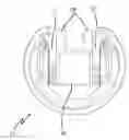 Fig. 01 - Knee cosmesis