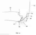 Fig. 07 - Knee cosmesis