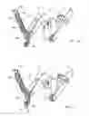 Fig. 07 - Cable tensioning in a robotic surgical system