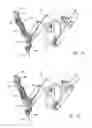 Fig. 08 - Cable tensioning in a robotic surgical system
