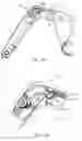 Fig. 16 - Cable tensioning in a robotic surgical system