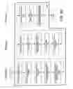 Fig. 08 - Mechanism for processor power state aware distribution of lowest priority interrupts