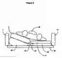 Fig. 04 - Support surface with integral patient turning mechanism
