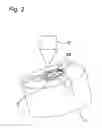 Fig. 03 - Method of making a component part of a reclining device