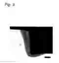 Fig. 04 - Method of making a component part of a reclining device