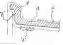 Fig. 01 - Method for marking a vehicle wheel for subsequent identification and tracking