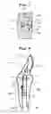 Fig. 05 - Magnet biased work tool