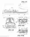 Fig. 08 - Sole construction for energy storage and rebound