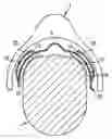Fig. 01 - Saddle pad having integrated plate-shaped spring device for pressure distribution and stabilization