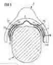 Fig. 02 - Saddle pad having integrated plate-shaped spring device for pressure distribution and stabilization
