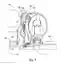 Fig. 02 - Cone connected torque converter