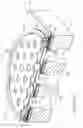 Fig. 24 - Dual wafer pressure sensor