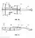 Fig. 07 - Stringed musical instrument having harmonic bridge