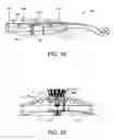 Fig. 11 - Stringed musical instrument having harmonic bridge