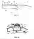 Fig. 12 - Stringed musical instrument having harmonic bridge