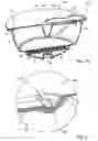 Fig. 08 - Methods and device for the preparation of a food product