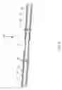 Fig. 09 - ADJUSTABLE TARPAULIN SUPPORT