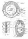Fig. 06 - Portable drag compressor powered mechanical ventilator