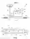 Fig. 02 - Power steering system frequency suppressor
