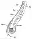 Fig. 01 - Tire with sacrificial strip for correcting dynamic imbalance