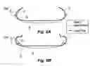 Fig. 07 - Assembly of tire and rim, and tire