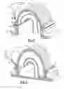 Fig. 03 - Method of maintaining appearance criteria in laser welded article air induction assembly