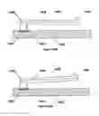 Fig. 06 -  Miniaturized Contact Spring