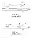 Fig. 02 - PROCESS AND COMPOSITION FOR PASSIVATING A SUBSTRATE DURING ELECTROCHEMICAL MECHANICAL POLISHING