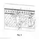 Fig. 07 - Modular container for the storage, organization, protection, sterilization and delivery of medical instruments and implants