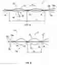 Fig. 05 - Solid-liquid filtration cloth and filtering device