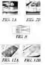 Fig. 05 - Fluid separation